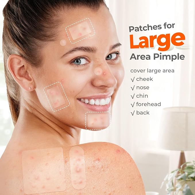 Large Acne Patches for Face, 7 Sizes Big Pimple Patches, XL Hydrocolloid Bandages for Body, Chin, Forehead, Nose, Back Blemish Zit Breakouts, Hydrocolloid Patch (Square, Strip, Dot 306 Count)