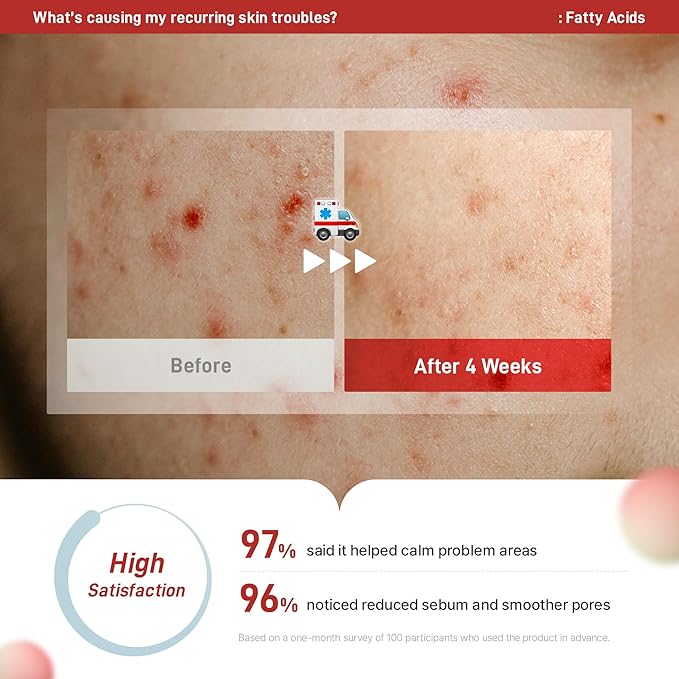 Zeroca 81 Korean Calming Cream for Acne-Prone & Oily Skin – Lightweight Barrier-Repair Moisturizer, Controls Sebum, Deeply Hydrates & Smooths Texture (2.02 fl.oz. 60 ml)