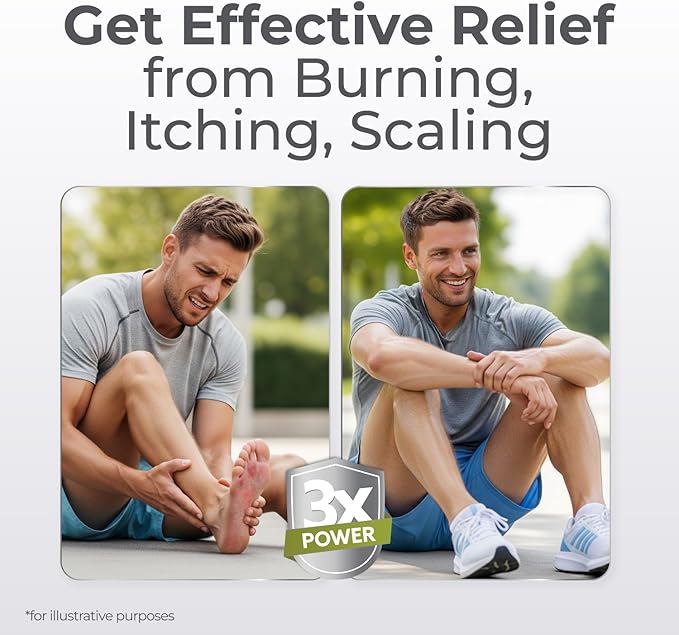 terrasil Athletes Foot Cream with Clinically Proven 1% Clotrimazole, Extra Strength Antifungal Ointment for Treatment of Itchy Feet & Peeling Skin, for Men and Women (1oz)