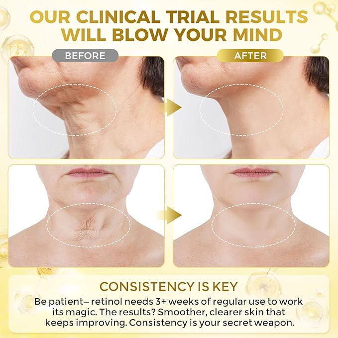 Neck Firming Cream, Anti Aging Wrinkle Cream with AH-8, Retinol, Collagen, & Hyaluronic Acid, Neck Creams for Tightening and Firming for Women & Men, Deep Hydration, Day & Night, 1.7 Fl Oz