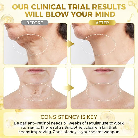 Neck Firming Cream, Anti Aging Wrinkle Cream with AH-8, Retinol, Collagen, & Hyaluronic Acid, Neck Creams for Tightening and Firming for Women & Men, Deep Hydration, Day & Night, 1.7 Fl Oz