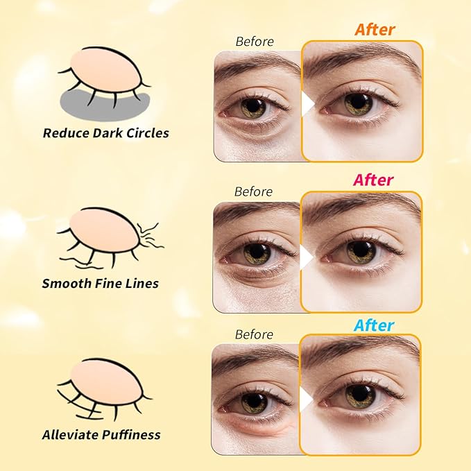 Under Eye Patches(48 Pairs), 24K Gold, Caffeine, Retinol Eye Masks for Puffy Eyes, Wrinkles, Dark Circles, Undereye Bags Treatment - Restoring & Awakening & Moisturizer Skin care Gift for Women