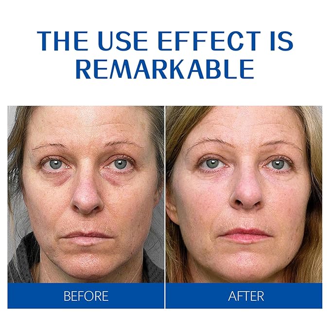 Age-Defiance Crème, Collagen & Retinol Formula for Skin Tightening and Firming, 30 g (1.0 oz)