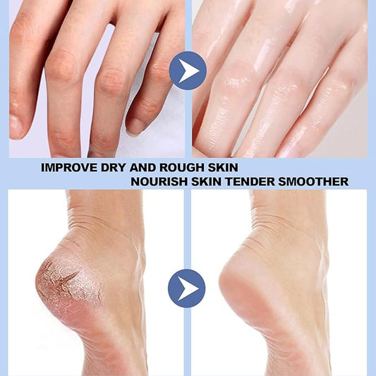 Crack Feet Prevention Stick, Anti Crack Foot Cream Stick, Foot Care Cream Cracked Feet, Moisturizing Foot Balm, Softening and Nourishing Cream for For Dry Heels