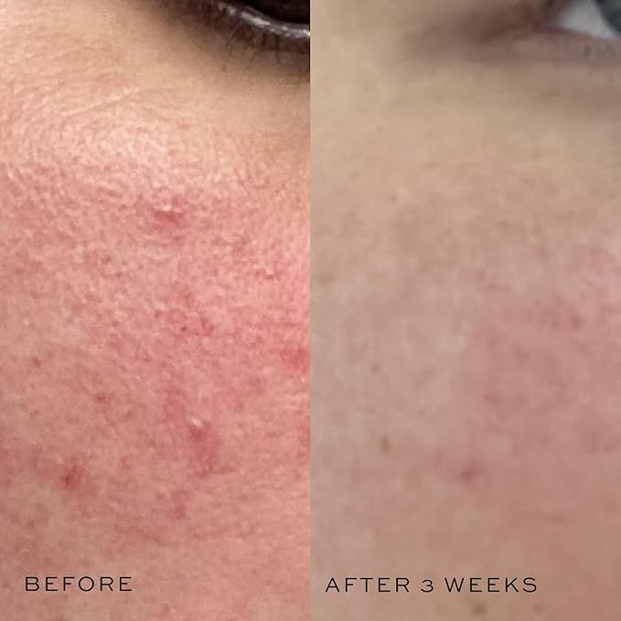 DIME Beauty Mini Super Skin Toner, Alcohol-Free Witch Hazel Toner, Travel-Size with Cucumber Extract, 2 oz / 60 ml