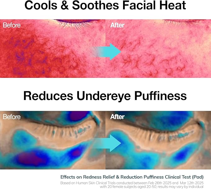 Ice Sorbet Toner Pads | Skin Prep Wipes for Puffiness, Under Eye Bags & Instant Face Lift | Gel Pads for Sunburn Relief & After Sun with 30% Glacier Water & Caffeine | Pack of 3 (180 Count)