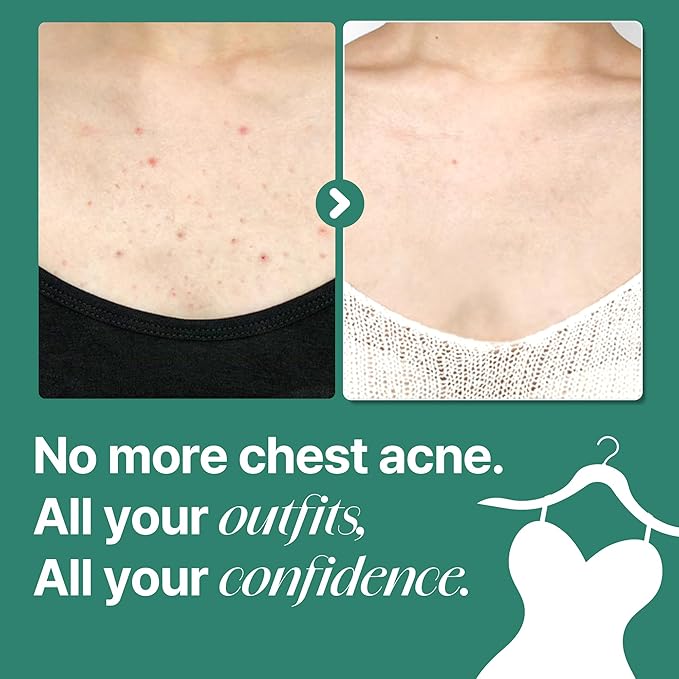 SOME BY MI AHA BHA PHA 30 Days Miracle Acne Clear Body Cleanser - 13.5oz, 400ml - Daily Exfoliating Tea Tree Acne Body Wash with Salicylic Acid - Deep Cleanses Sebum and Impurities - Korean Skin Care