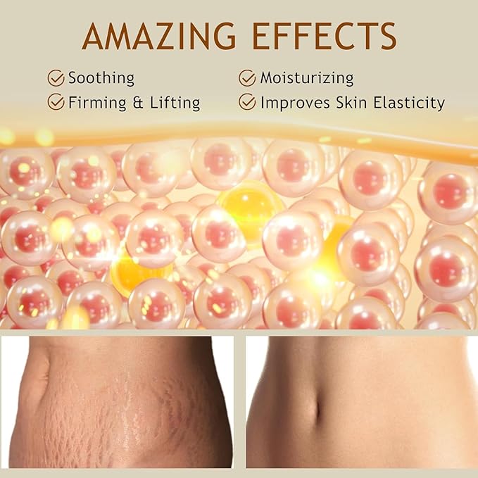 B Flat Belly Firming Cream - Stretch Mark Treatment - Clean and Gentle Belly Cream - Skin Tightening Cream for Cellulite for Stomach Mark & Thighs & Butt, Moisturizing Lifting Body Lotion