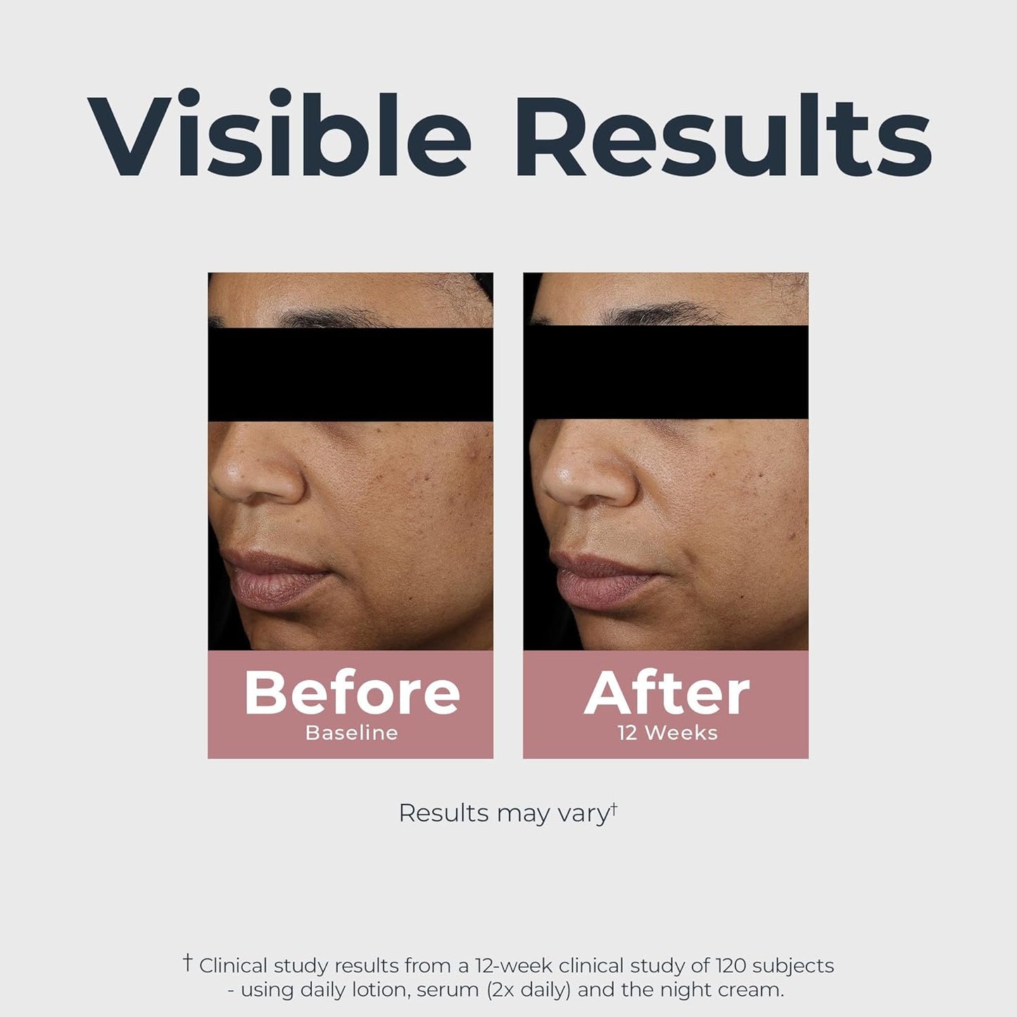 Radiant Tone Face Moisturizer with SPF 30 – Dark Spot Corrector with Thiamidol for Hyperpigmentation – Daily Anti-Aging Lotion for Uneven Skin Tone & Dark Spots – For All Skin Types, 1.7 Fl Oz