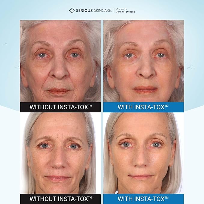 Serious Skincare INSTA-TOX Instant Wrinkle Filler for Face Serum, to Smooth + Blur Fine Lines, Deep Wrinkles, Lip Lines, Crow’s Feet & Pores, Temporary Face Tightener, .75 oz