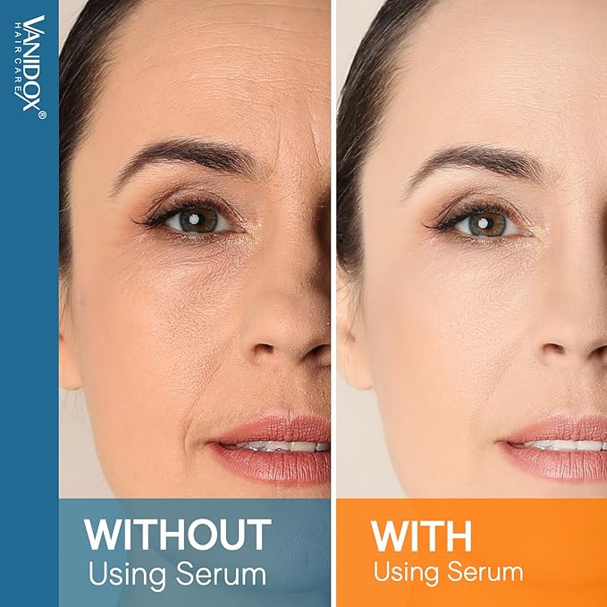 Super Vitamin C Serum for Women Over 70, All-In-One Formula, Made in USA, Hydrates, Firms, Lifts, and Targets Wrinkles, Age Spots, and Fine Lines, Vitamin C Serum (1fl oz x 2)