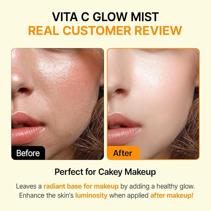 Vitamin C Glow Mist for Radiant Skin, Hydrating Serum Mist with Niacinamide & Glutathione, Korean Vegan Skincare, 3.38 Fl Oz