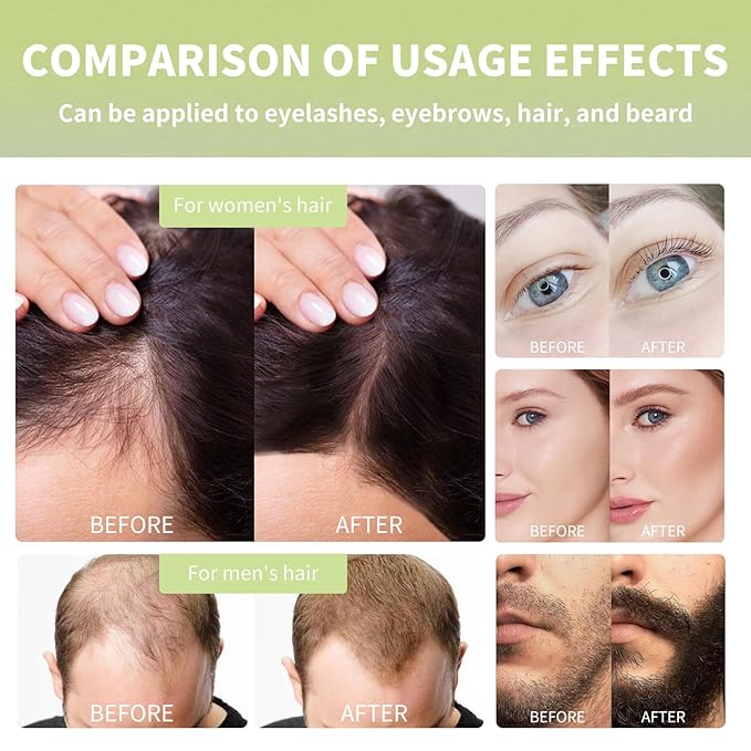 Cold Pressed Black Castor Oil for Hair Growth, 2 Pack - with Biotin, and Caffeine and oils like Coconut , Rosemary, Argan, for Hair, Eyelashes, Eyebrows, and Beard Care