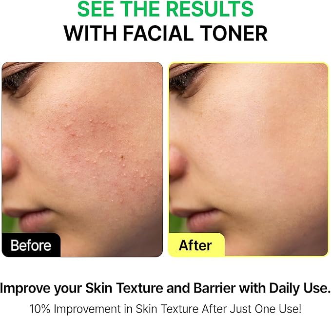 VEGANIFCET Essence, Ultra Hydrating, for Glowing Skin, Korean Skin Care, Vegan, 6.76 Fl Oz