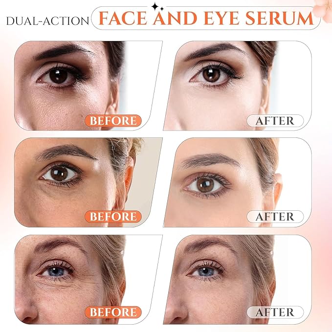 Super Vitamin C 20% Serum for Women, Dark Spot Remover for Face, CE Ferulic Acid, Hyaluronic Acid, Retinol, Hydrate & Plump Skin Care Anti Aging Wrinkle Brightening Skincare -1 Fl Oz.