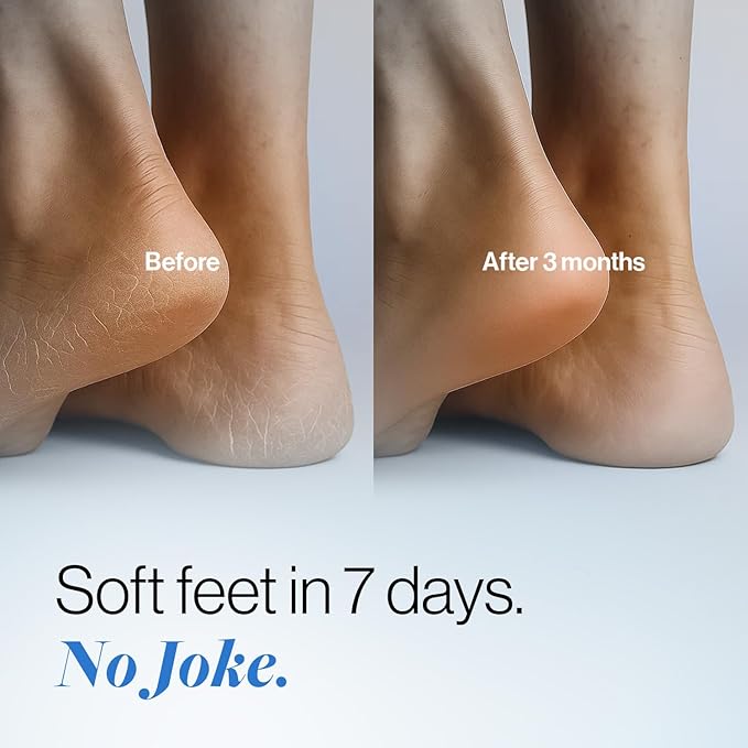 Be Bodywise 20% Urea Foot Cream Roll On 50ml | For Dry, Cracked Heels and Feet | With Lactic Acid, Olive Oil & Vitamin E | Helps Repair and Moisturise Cracked Heels