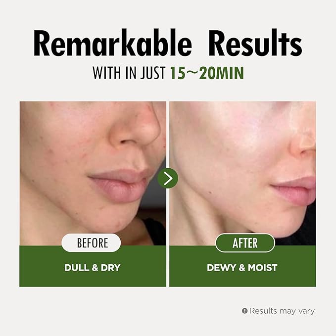 FARMSKIN Superfood Salad Sheet Mask Set of 6 | Korean Face Mask Sheets w/Mangosteen, Broccoli, Carrot, Coconut, Blueberry & Tomato | Refreshing, Nourishing & Cruelty-Free Face Mask Skincare Set