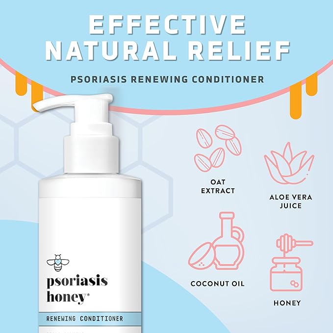 Renewing Conditioner - Dry Scalp Treatment - Psoriasis Cream for Dry Hair - Coconut Oil Hair Moisturizer Helps Relieve Symptoms of Eczema, Dandruff, Dermatitis & More (8oz)