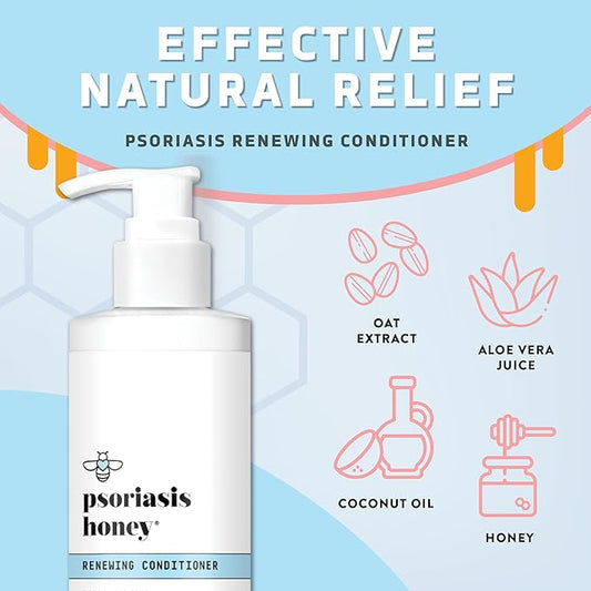 Renewing Conditioner - Dry Scalp Treatment - Psoriasis Cream for Dry Hair - Coconut Oil Hair Moisturizer Helps Relieve Symptoms of Eczema, Dandruff, Dermatitis & More (8oz)