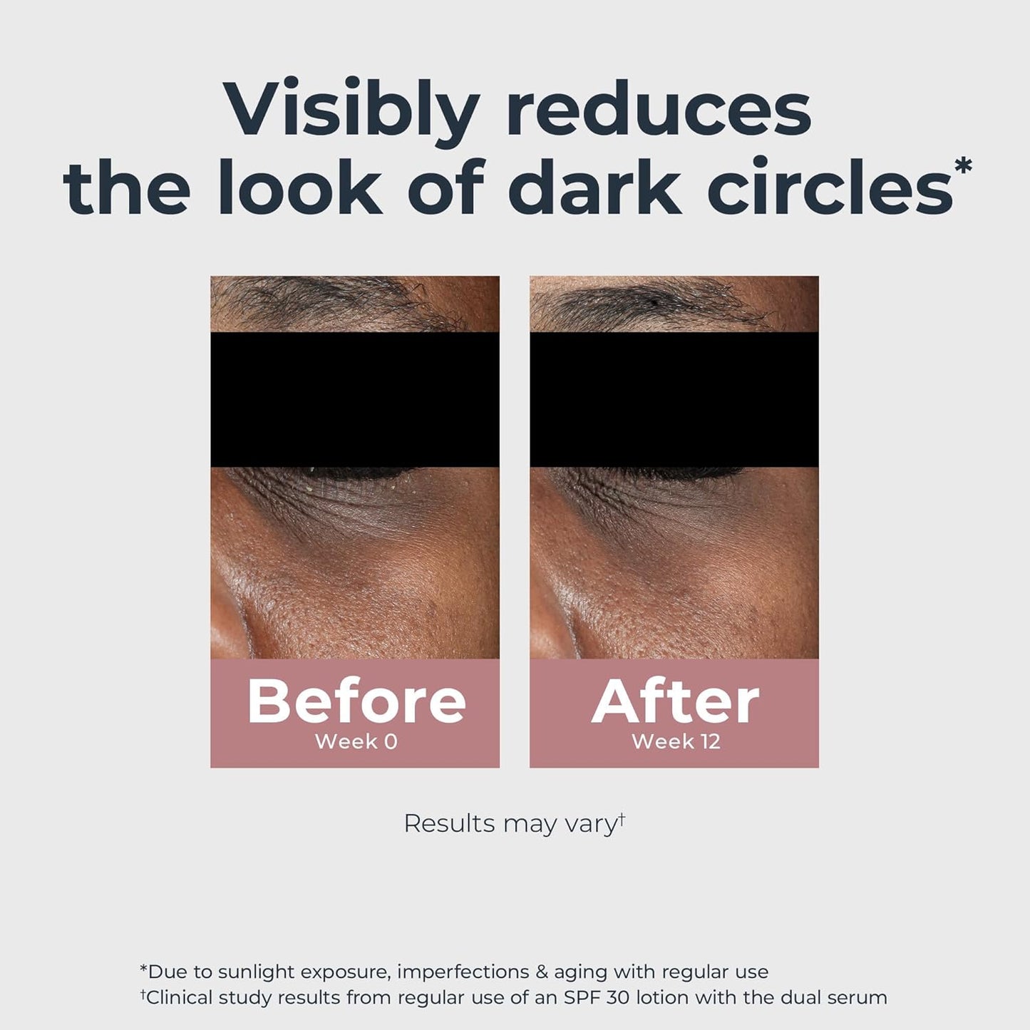 Radiant Tone Eye Cream – Dark Circle Corrector, 0.5 oz 👁️✨