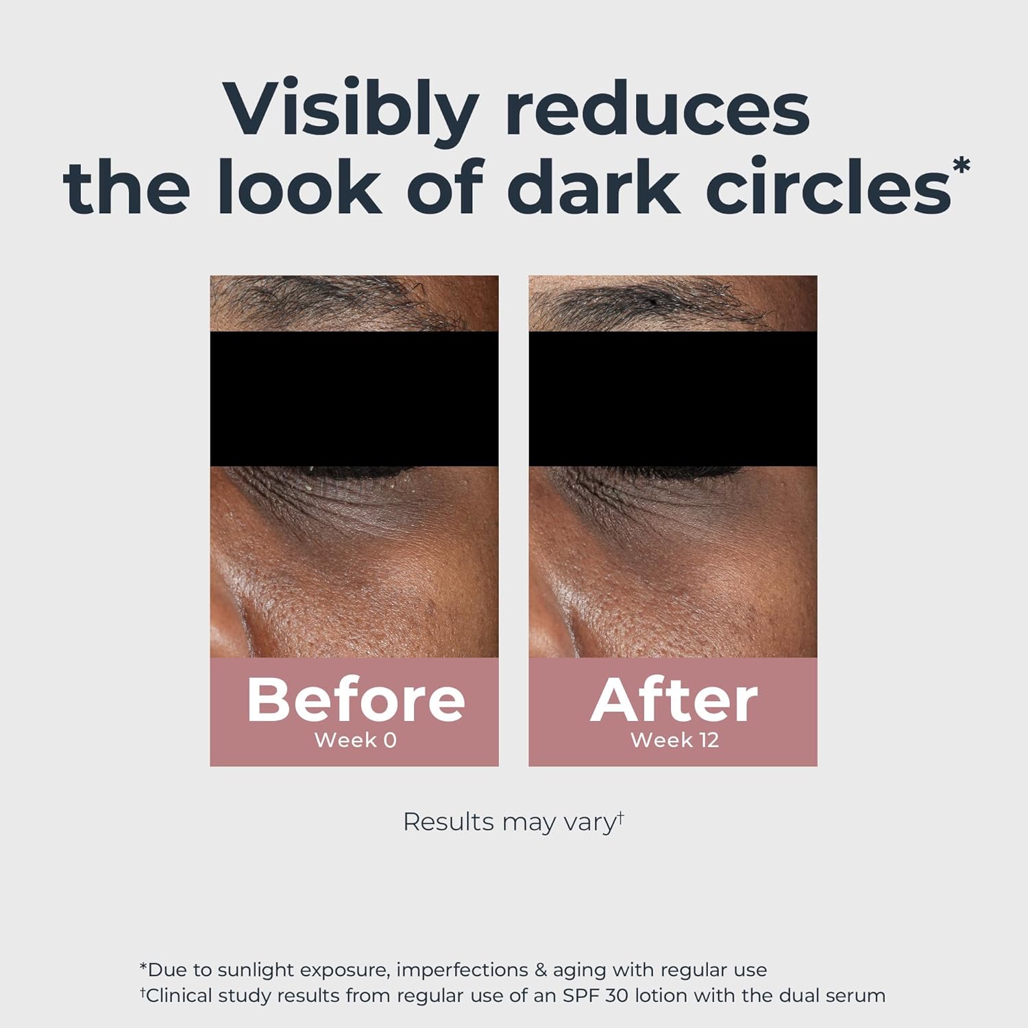 Radiant Tone Eye Cream – Dark Circle Corrector, 0.5 oz 👁️✨