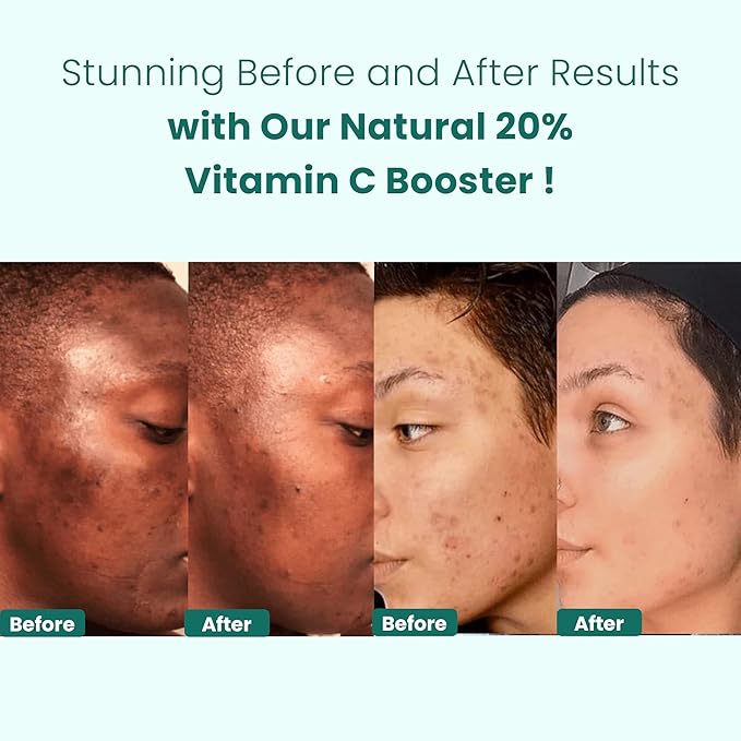 Gin Amber Beauty - Pack of 4 Serums (1 fl oz - 30 ml)