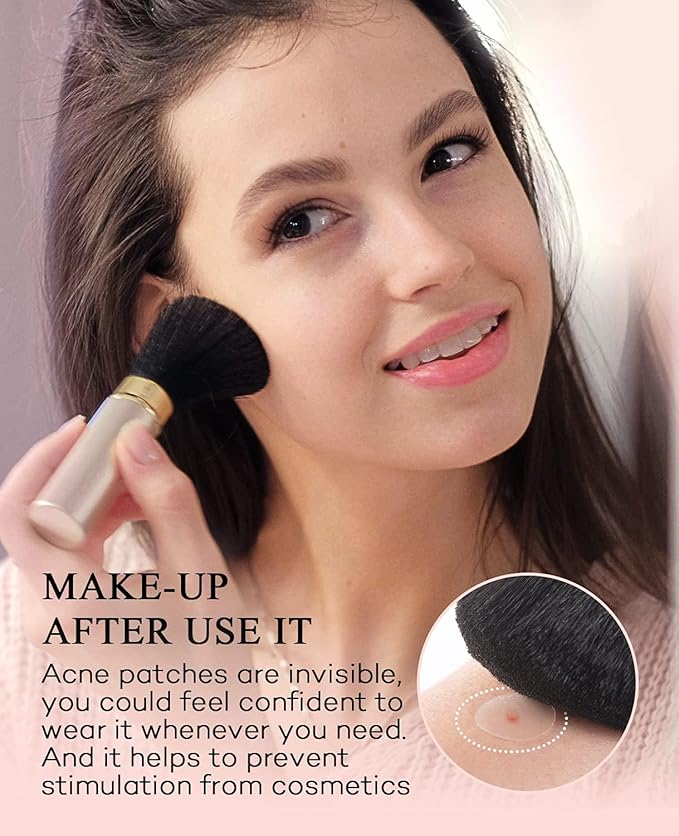 TKTK Hydrocolloid Acne Patches, Pimple Patches for Face with Tea Tree & Calendula Oil - 4 Sizes Clear Cover Stickers, Invisible for Day & Night Use (360 Count)