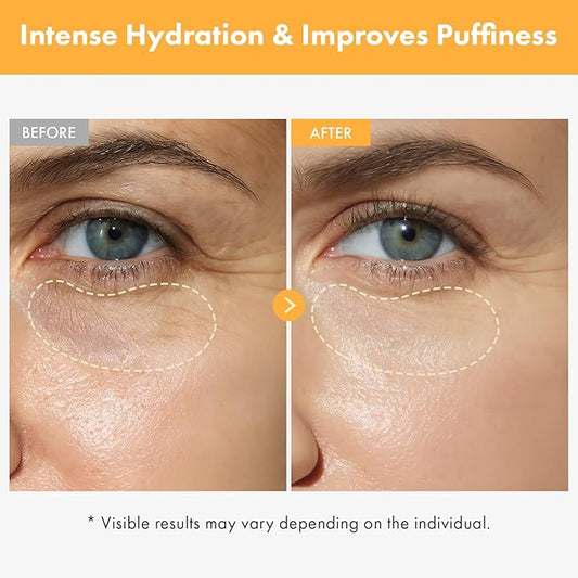 VITA Clinic Vitamin Eye Cream, Korean Skincare with 5% Arbutin, 2% Niacinamide, Hyaluronic Acid, Glutathione, Seabuckthorn Eye Serum for Fine Lines & Wrinkles, Puffiness, 15ml / 0.5 fl. oz.