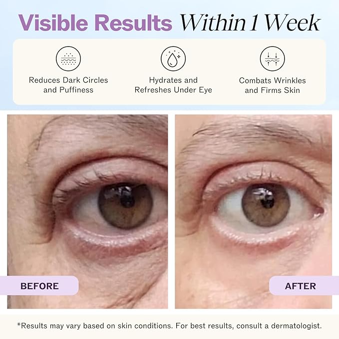 LilyAna Naturals Eye Cream for Dark Circles and Puffiness, Under Eye Cream for Wrinkles and Bags, Anti Aging Cream helps Improve Dryness; for Sensitive Skin 0.5 oz