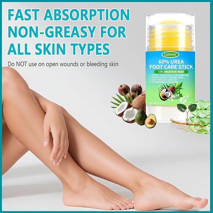 60% Urea Cream Stick with 2% Salicylic Acid, Anti-Cracking Foot & Hand Cream Moisturizer for Dry Cracked Heel Feet, Knee, Elbow, Foot Balm Stick for Callus Remover & Dead Skin Softener (1)