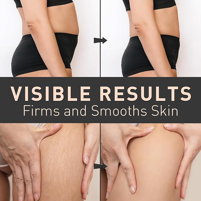 Enaskin Naturals Belly Firming Cream: B Flat Skin Tightening, Cellulite & Stretch Mark Reduction Cream for Stomach, Thighs and Booty - Hydrating Body Lotion for Women & Men, 3.38 Fl. Oz