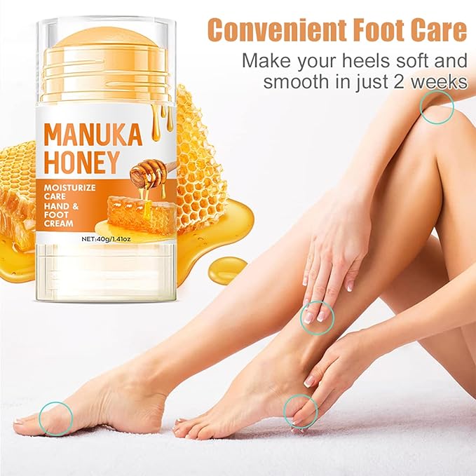 60% Urea Cream - Manuka Honey Foot Hand Cream Stick for Dry & Cracked Feet Elbows Knees Heels Hands, Hydrates & Nourish Foot Care for Softening and Moisturizing, Removing Calloused Skin