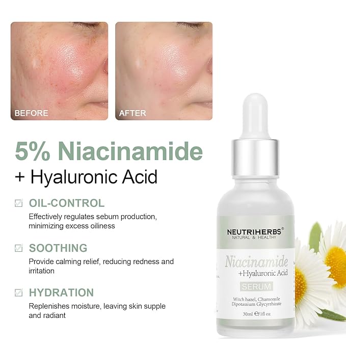 Neutriherbs 5% Niacinamide Serum for Face the Ordinary + HA,Effectively Work to Control Excess Facial Oil, Minimize the Pores and Prevent Breakouts, Best Niacinamide Serum For Oily Skin