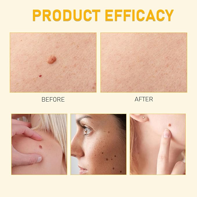 Bee Venom Skin Restoration Cream, Bee Venom Comprehensive Cream,Professional BeeVenom Skins Creams, Firming & Wrinkle-Reducing Creams,Natural Skin Moisturizer for All Skin Types(2PCS)