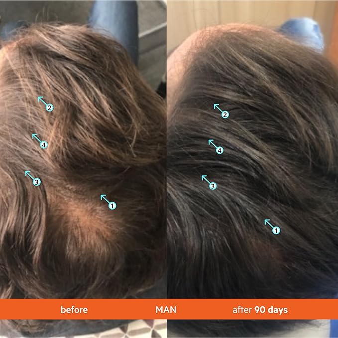 DS Labs Revita Shampoo & Conditioner Kit, 205 mL – Scalp First System for Fuller Looking, Volumized Hair, Lightweight Hydration, Sulfate & Silicone Free, Color Safe, For Men & Women