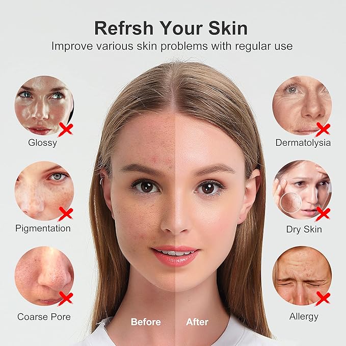 Newbealer Facial Steamer, Mini Aroma Face Steamer, Nano Ionic Hot Mist Face Humidifier for Facial Deep Cleaning, Home Sauna Spa Sprayer with 9 Pieces Acne Remover Kit (Blue, 160ml)