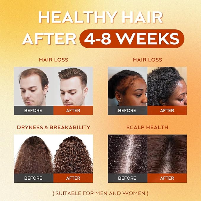 Raw Batana Oil for Hair Growth Dr Sebi, 100% Pure Organic Batana Hair Mask from Honduras, Wild Growth Hair Oil, Scalp Oil Promotes Hair Thickness, Prevents Loss for Men & Women, 2 fl oz (1 Pack)