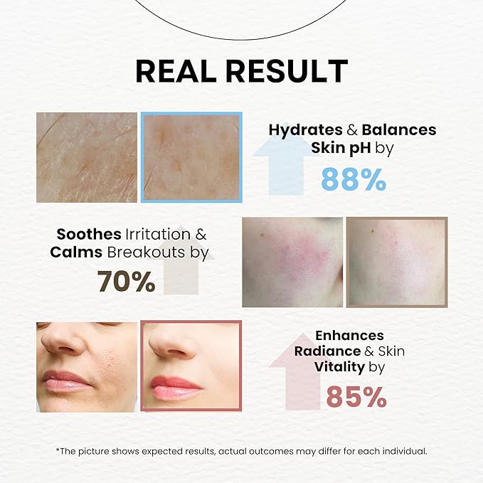 MPC Aqua Soothing Toner & Mist – Deep Hydrating & Calming and Restoring PH Balance with Caviar, Peptides, Rosa Centifolia, Latobasilius & CICA Extract, Premium Korean Toner, 6.76 fl oz