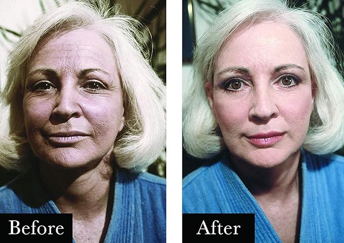 Boyd's Renoir No Lines Temporary Wrinkle Remover- For Forehead, Eyes, Lips, 0.5 fl oz (5-Pack)