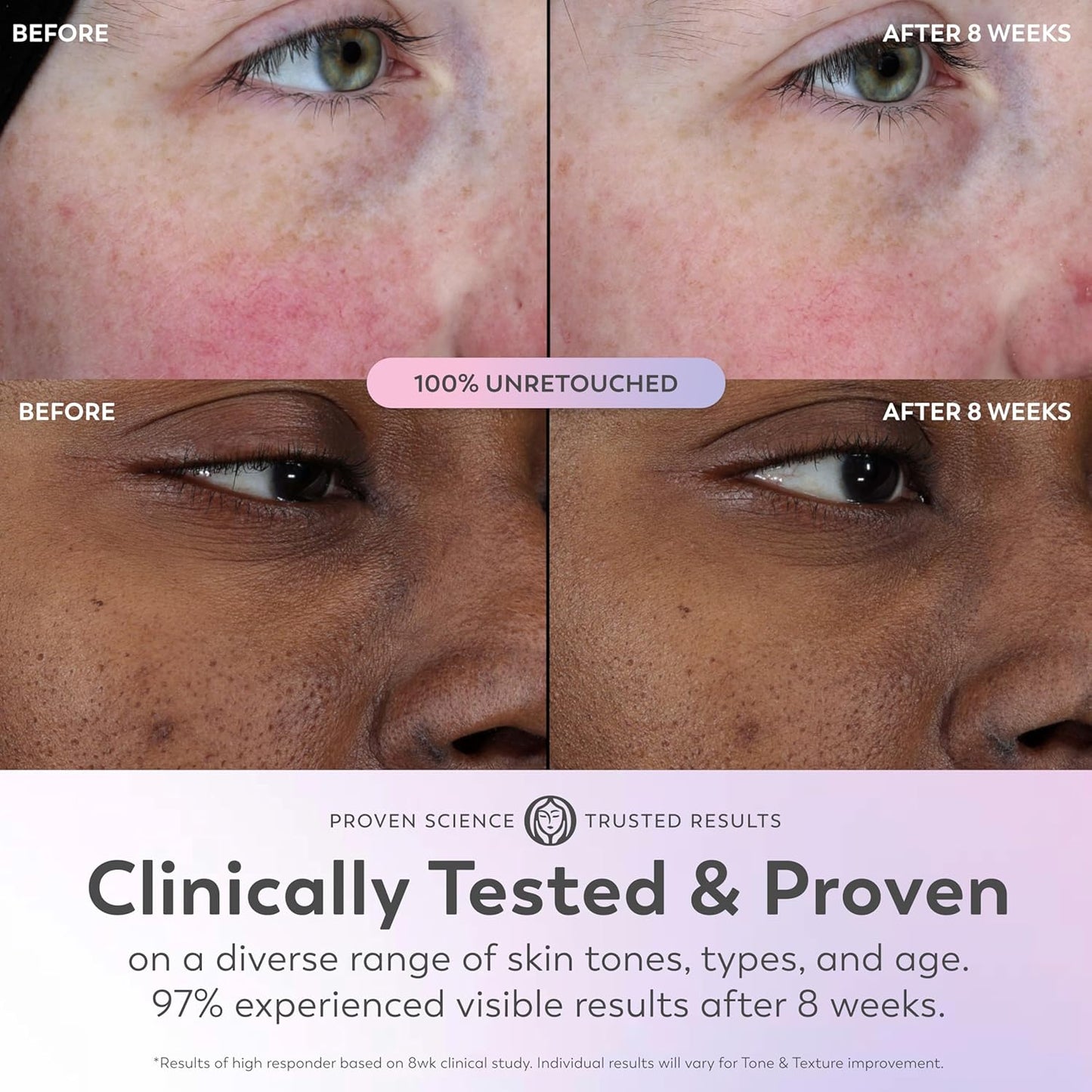 Super Serum with Niacinamide, Vitamin C & E, Collagen Peptide & AHA – 5-in-1 Anti-Aging Serum for Brightening, Hydrating, Smoothing, Firming & Even Skin Tone, 1.7 oz