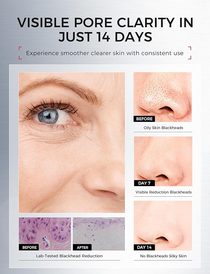 Clay Mask for Face Sensitive Skin: Triple Mud Formula, Deep Pore Cleansing, Hydrating, Oil Balancing, Smoothing, Pore Refining – 3.88 Oz