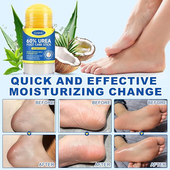 2Pcs Urea Foot Cream Stick, Urea Cream 60 Percent for Feet Maximum Strength, Foot Cream for Cracked Heels and Dry Skin, Cracked Heel Repair Cream, Foot Moisturizer, 1.41 Oz