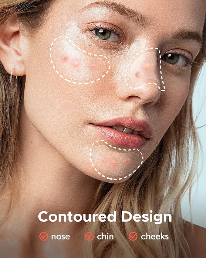 LitBear Acne Patches Large, Hydrocolloid Pimple Patches for Breakouts, Zit and Blemish, Acne Patches for Face, Chin, Back and Body with Tea Tree Oil