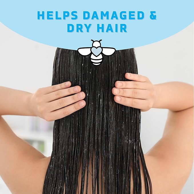 Renewing Conditioner - Dry Scalp Treatment - Psoriasis Cream for Dry Hair - Coconut Oil Hair Moisturizer Helps Relieve Symptoms of Eczema, Dandruff, Dermatitis & More (8oz)