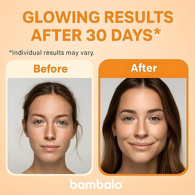 Vitamin C Serum - Radiance Brightening Face Serum With Niacinamide, Retinol, Hyaluronic Acid, Aloe, B5 & Botanical Extracts - 1 FL OZ / 30ML