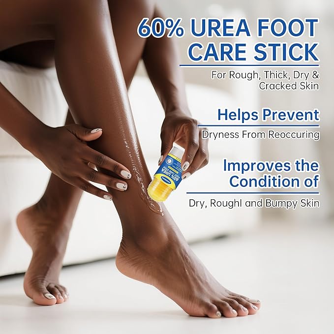 60% Urea + 2% Salicylic Acid Foot Cream–Ultra-Moisturizing Formula, Exfoliates Dead Skin, Softens Dry, Cracked Skin on Feet, Knees, Hands, Elbows. Helps soften callused, rough, or tender areas 2.82oz