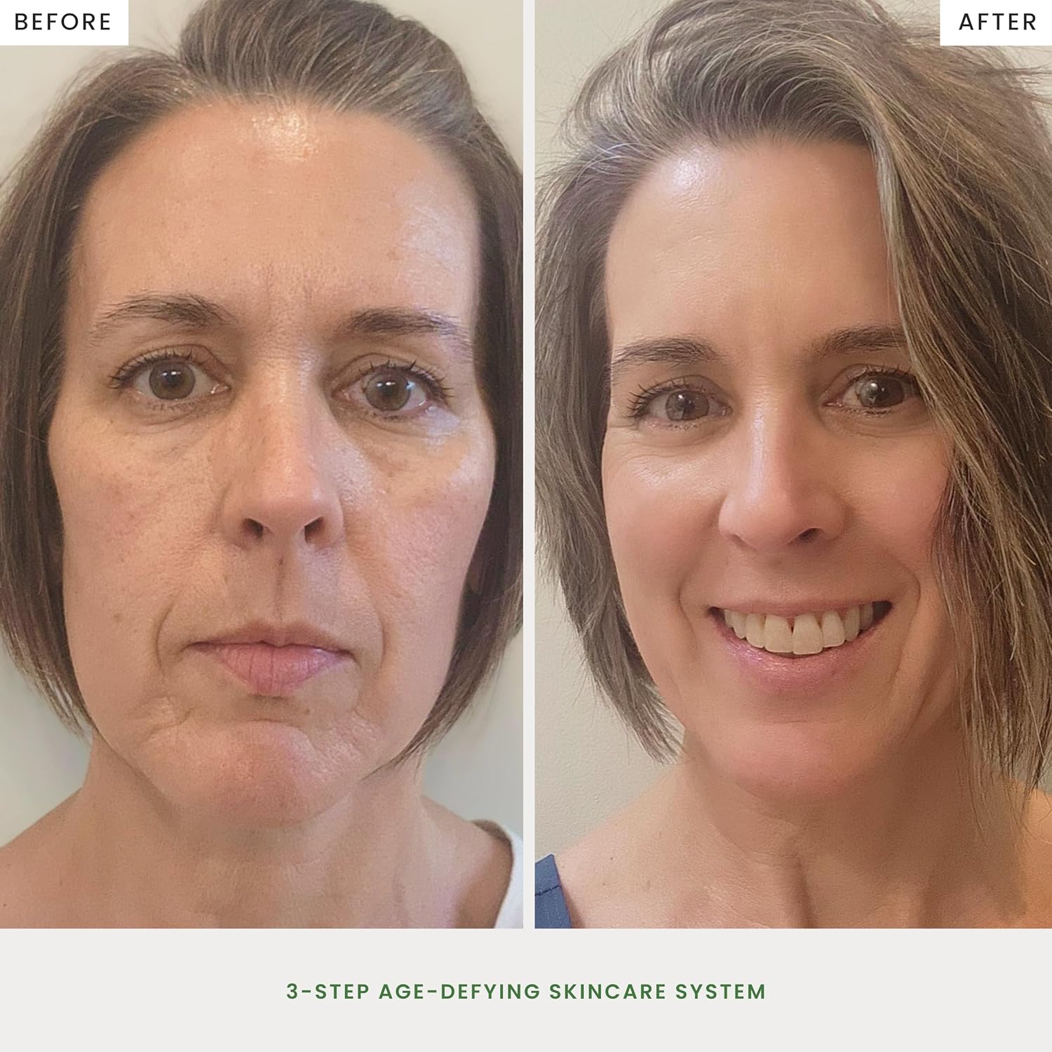 ✨ 3-Step Age-Defying Skincare Set