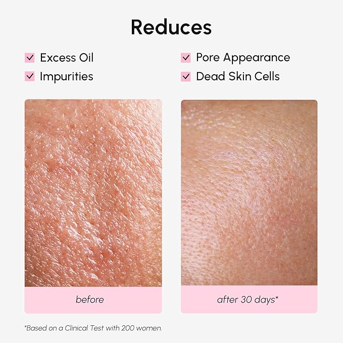 MAREE Pore Minimizer for Face Toner – Oil Control Facial Toner with Niacinamide, Witch Hazel & Marine Collagen – Gentle Exfoliating Face Toner for Women – Oily, Normal, Sensitive Skin – Tonico Facial