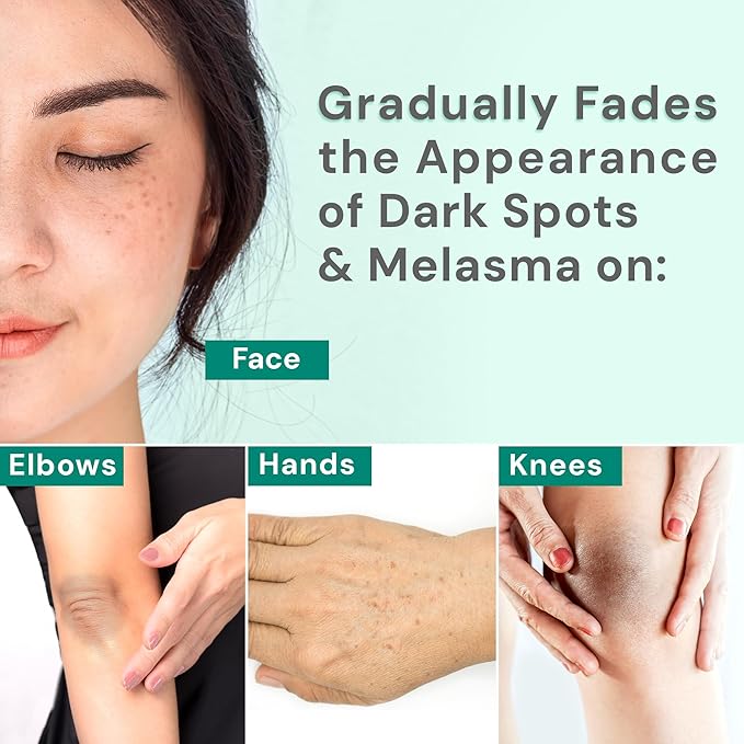 Ebanel Dark Spot Remover for Face & Body, Brightening Serum with Synovea HR, Alpha Arbutin, Niacinamide, Kojic Acid, Dark Spot Corrector for Hyperpigmentation, Discoloration, Melasma and Age Spots