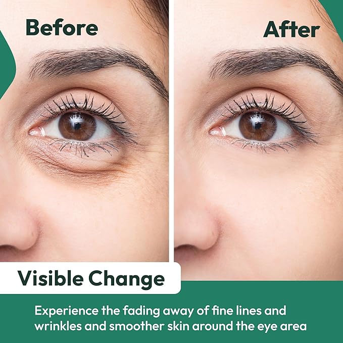 Vivo Per Lei Vitamin C Eye Cream - Retinol Eye Cream for Wrinkles - Moisturizing Eye Cream for Puffiness and Bags Under Eyes - Anti Aging Eye Cream with Peptides - 1.7 Fl. Oz.